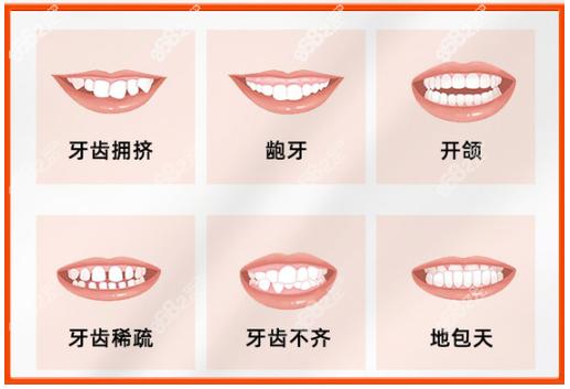 哪家口腔机构更优越？遵义双宁口腔医院与遵义皓和口腔门诊部的齐全对比解析