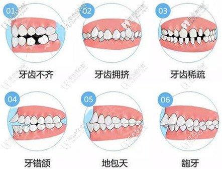 合肥爱乐雅口腔医院怎么