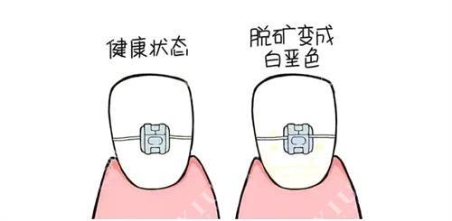 2025年南京牙科价格表，种植牙-牙齿矫正-拔牙补牙洗牙收费标准
