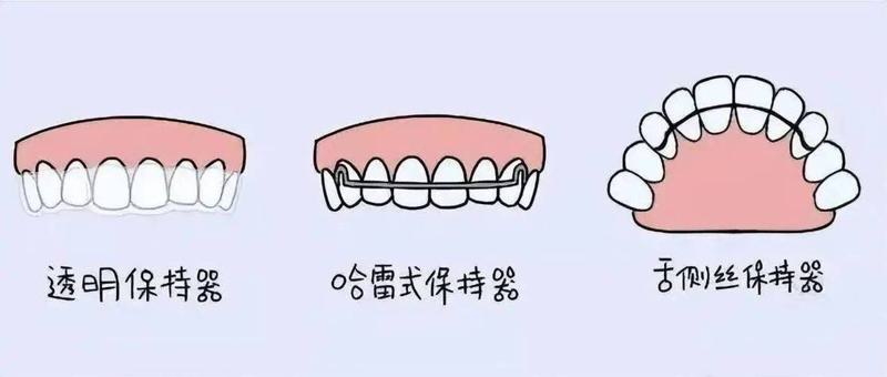 台州临海麦尔口腔门诊部怎么样？种植牙-牙齿矫正-补牙口碑好,价格还不贵