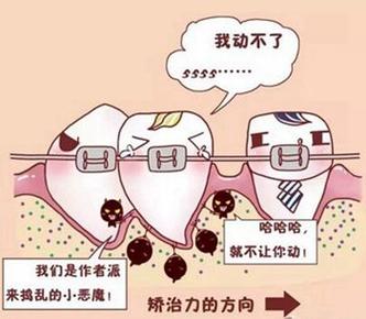 重庆亚太口腔门诊部牙套