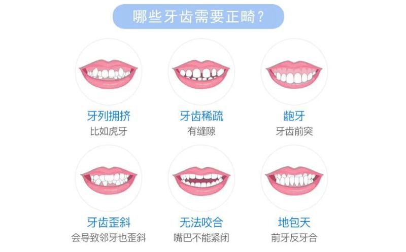 牙齿矫正越早越好吗？9岁矫正牙齿会不会太早？