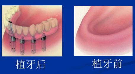 烟台拜尼科口腔医院怎么