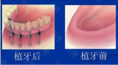 上海哪家医院有3D数字种