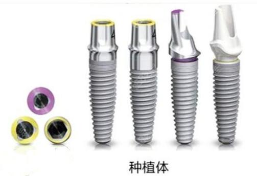 在私立的西安画美团圆口腔做种植牙多少钱一颗，都晓得不