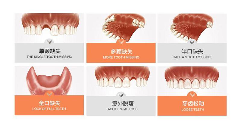 山东临沂亿美口腔门诊部石文博医生种植牙2180元起，价格低但质量好
