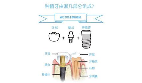 宁远雅美康口腔医院电话