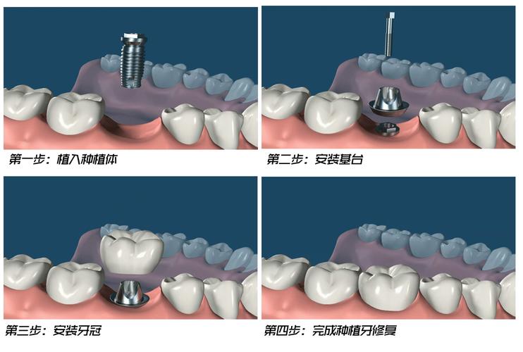 株洲石峰区正规口腔医院排名？这3家实力机构口碑与技术双优