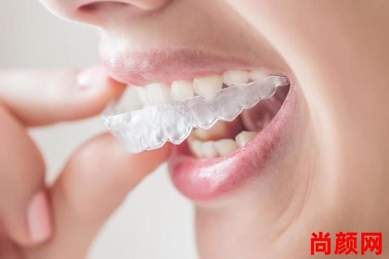 成人牙齿矫正要多久—成人牙齿矫正要多久才好