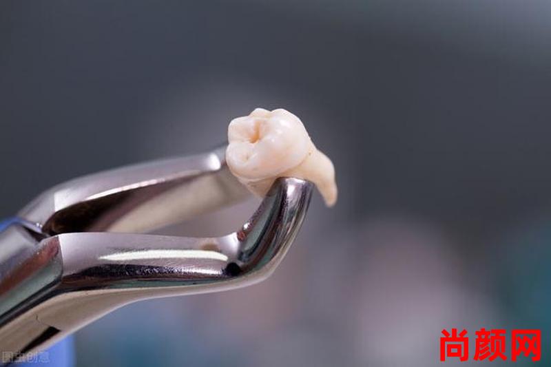 拔智慧牙要多久,拔智慧牙要多久时间