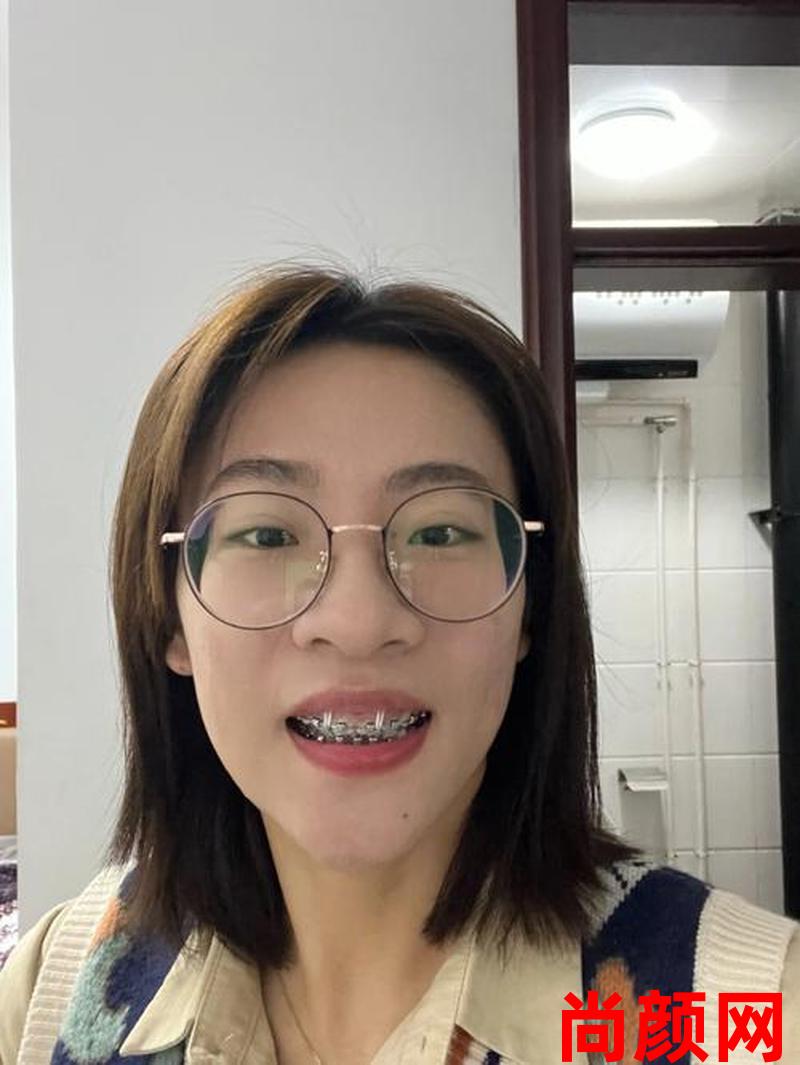 牙齿矫正一般需要多久,牙齿矫正一般需要多久复诊一次