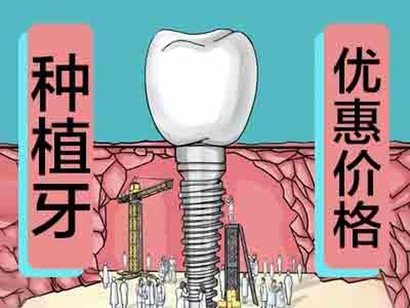 两次种牙种植体不一样_两次种牙种植体不一样正常吗