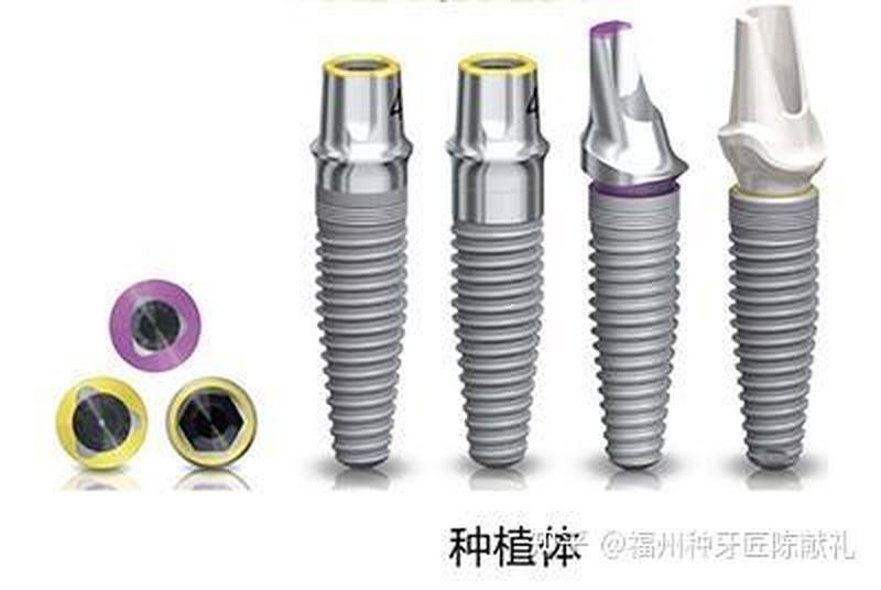 两颗牙共用一个种植体—两颗牙共用一个种植体怎么办