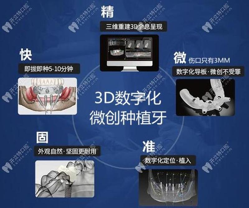 做3d种植牙多少钱一颗—做3d种植牙多少钱一颗合适
