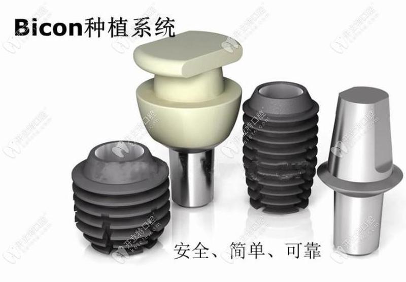 可以一个种植体带两个牙吗_可以一个种植体带两个牙吗图片
