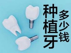 广州一颗门牙种植牙多少