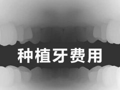 深圳种植牙一颗多少钱一