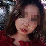 武汉皓诺口腔门诊部朱友家牙齿矫正案例分享