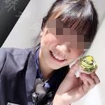 武汉第一口腔医院黄薇牙齿矫正案例分享
