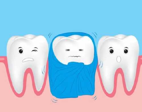 海涛口腔医院补牙多少钱？影响价格的因素有哪些？真人补牙体验反馈！