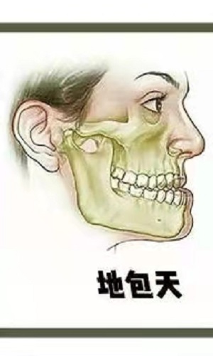什么叫做地包天?内含价格表及案例分析