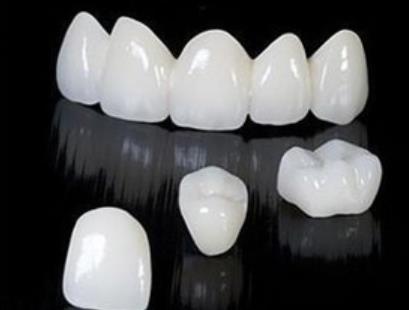 3mlava全瓷牙多少钱？哪些因素影响3mlava全瓷牙费用？3mlava全瓷牙使用多少年？