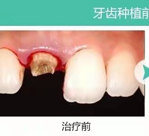 劲松口腔医院靠谱吗？内含价格表及案例分析