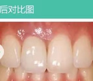 劲松口腔医院靠谱吗？内含价格表及案例分析