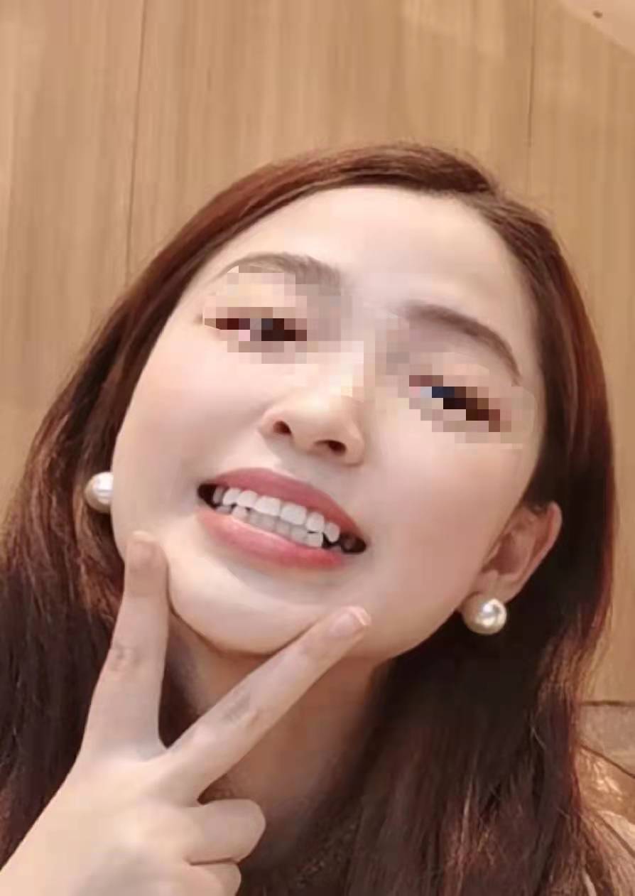 南宁柏乐口腔医院怎么样？附案例分析和价格表