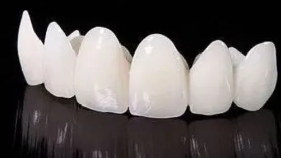 1000元的全瓷牙和1500的区别什么?有什么不同?
