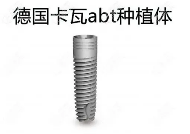 南京秦淮沃雅口腔诊所种植牙价格贵吗？设备先进，可提供多种植牙方案！