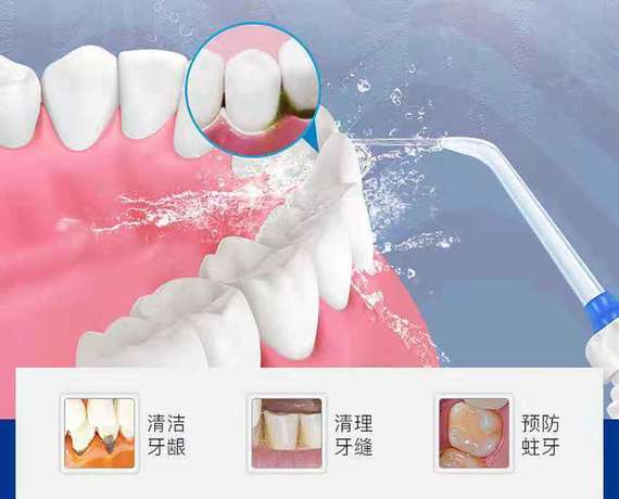 昆明牙齿清洁2024价格表:韩国美格真种植牙/颗:6500元起/莱顿BLB种植牙:1000元起