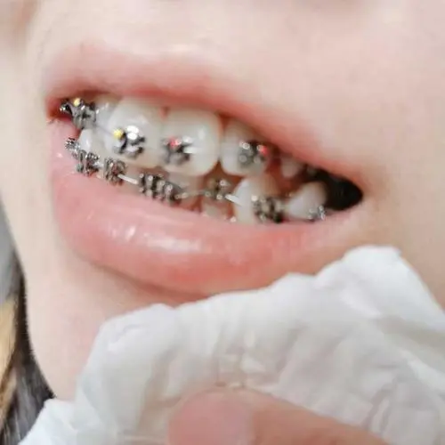 荆州牙齿矫正2024价格表:以色列dentin(丹因)种植牙价格:2000元起/德国BEGO(贝格)种植牙价格:2000