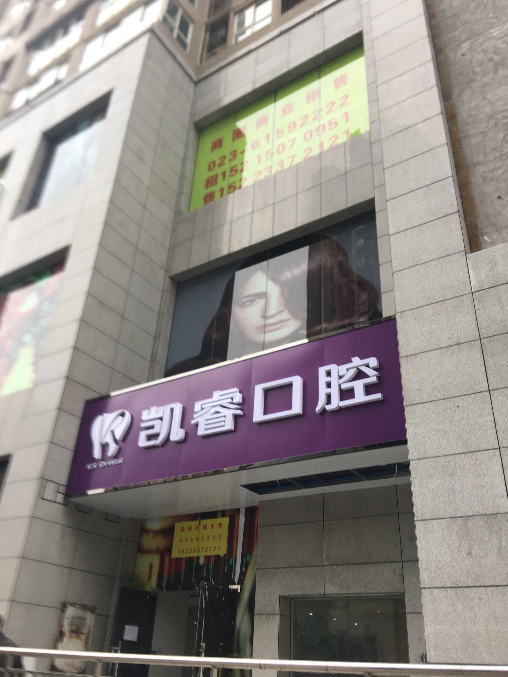 重庆瓷贴面价格在线公布(2024重庆瓷贴面参考价为：2043元)
