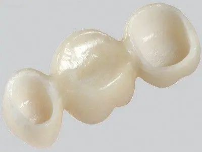 遵义全瓷牙种植2024价格表:以色列dentin(丹因)种植牙价格:2000元起/韩国纽百特Neo种植牙:1200元起