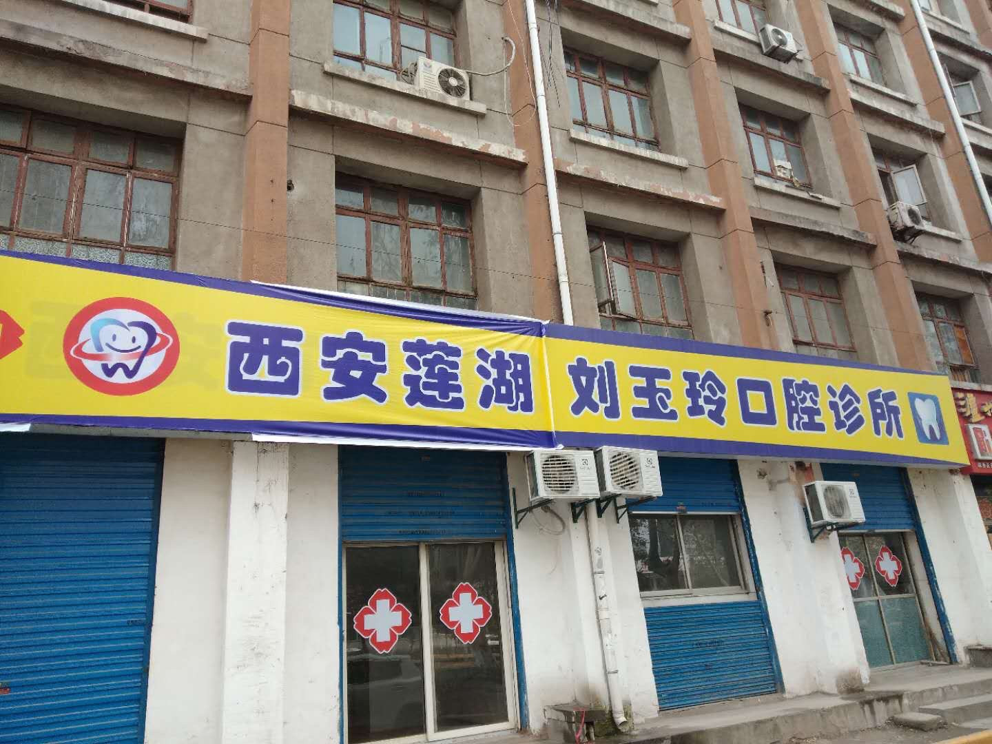 西安瓷贴面价格表线上公布(2024西安瓷贴面参考价为：2076元)