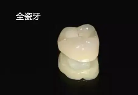 汉中全瓷牙种植2024价格表:韩国纽百种植牙价格:1100元起/德国费亚丹种植牙/颗:2400元起