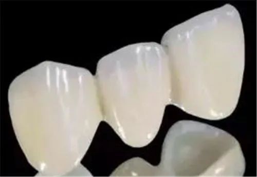阿曼吉尔巴赫全瓷牙多少钱？我花1300元能镶吉尔巴赫全瓷冠吗