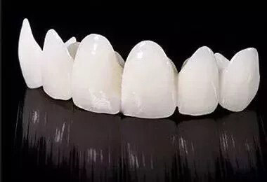 臻瓷牙冠是进口的还是国内生产的？德国进口一线全瓷牙品牌