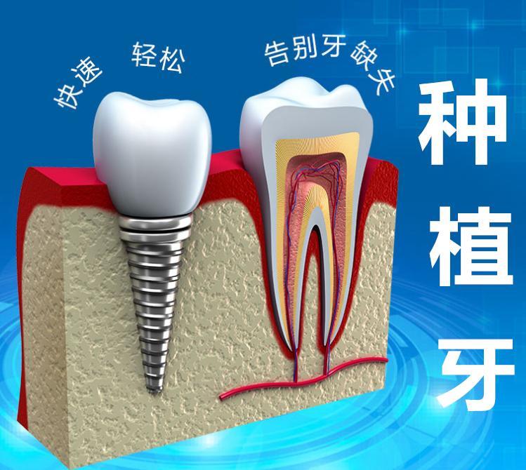 成都西南口腔医院预约挂号+电话分享，线上好挂号还可约医生