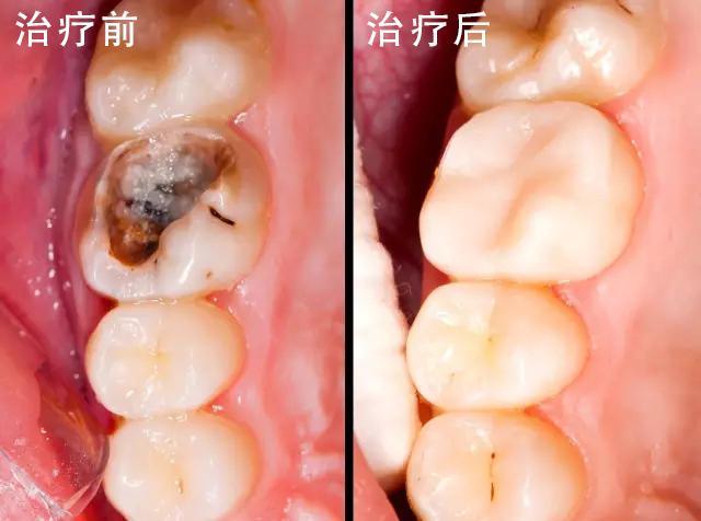 深圳友善口腔口碑点评高、4.4颗星推荐、种牙2980元起、收费便宜
