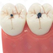 平潭爱维口腔贵吗(价格