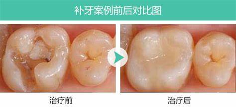 雅仕口腔是连锁还是加盟的？正规医院不坑人、中高端档次品牌
