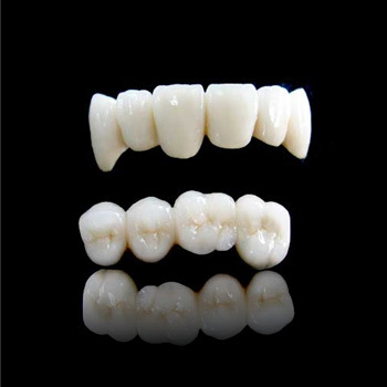 威兰德牙冠属于什么级别？中高端，含威兰德牙冠优缺点、寿命