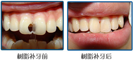 福州奇志口腔医院怎么样_正规靠谱_六一路店种牙好_价格表