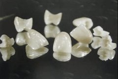 吉尔巴赫全瓷牙2000一颗