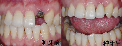 [张家界十大口腔医院排名榜]张家界好的牙科医院都在这儿