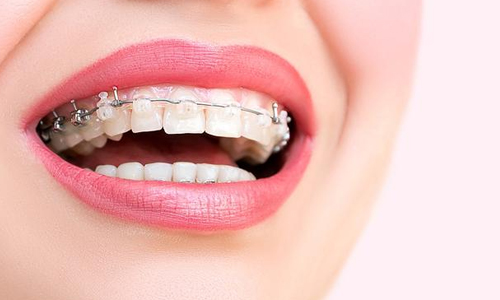 求问：拔牙掩饰性正畸后还能正颌吗？还可以正颌但价格较贵哦
