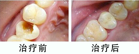 中山大象口腔医院是几级医院，2级口腔医院并且收费还不贵