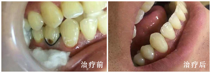 龙岗中心医院口腔科预约挂号-可网上、电话预约，附放号时间